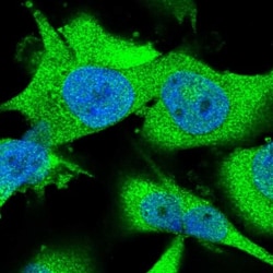 ARHGAP27 Antibody, Novus Biologicals 0.1mL; Unlabeled:Antibodies, Polyclonal